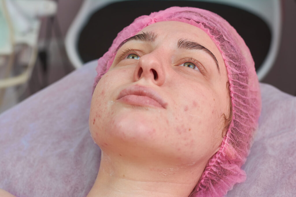 Female face close up, cosmetology.