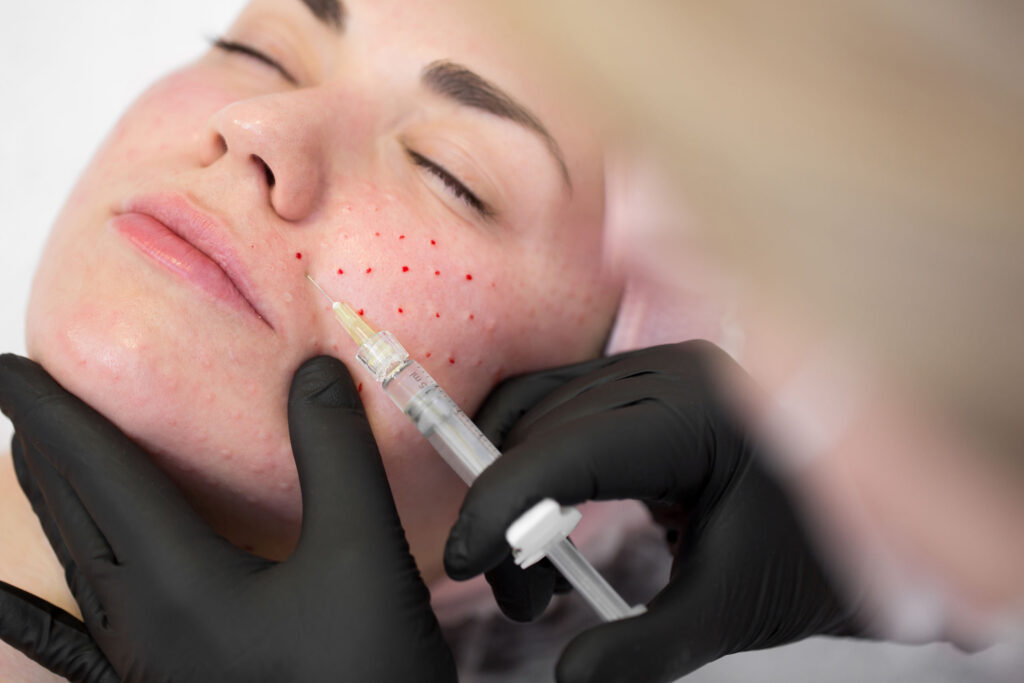Close up of cosmetologist makes the Rejuvenating facial injections procedure for tightening on the face skin of woman in a beauty clinic. Biorevitalization procedure