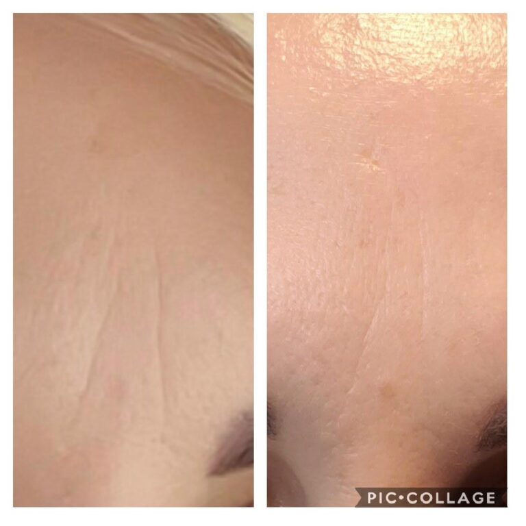 Wrinkles cheek closeup