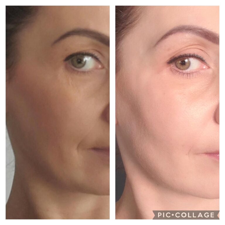 Wrinkles face overall