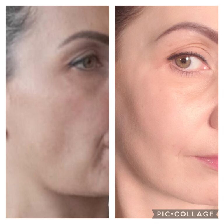 Wrinkles face overall